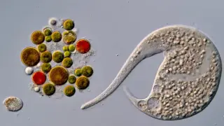 Nikon Disqualifies Microscopy Video Winner After AI Manipulation Scandal