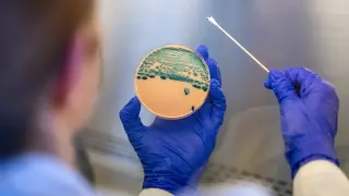 CDC Data Shows Drug-Resistant Shigella Cases Rising Among Adult Men