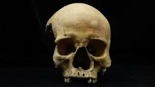 Archaeologists Identify First Physical Evidence of Punitive Nose Amputation in 14th-Century China