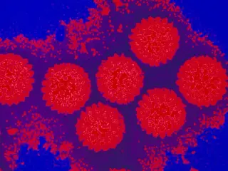 NJ Rotavirus Surge Tied to Wastewater Signals