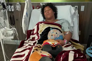 Florida teen hospitalized after flesh-eating bacteria infection from swimming