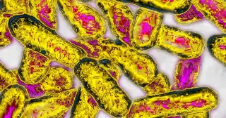 Legionella Outbreak at Kaiser Santa Clara Reaches 18 Cases