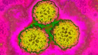 Global Study: 12% of Cancers Are Preventable Infections
