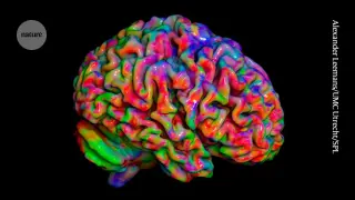Decade-long study maps insula’s distinct zones for pain, visceral, and cognitive sensations