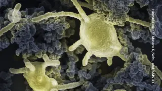 Cultured Asgard microbes illuminate the origins of complex life