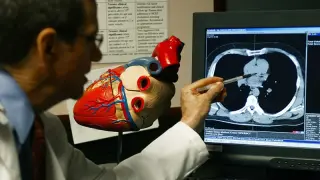 NZCR-MESA Score May Guide CT Protocols by Predicting Coronary Calcification