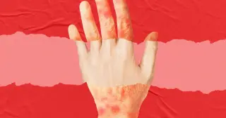 Rubedo’s Topical Cream Cuts Skin Biological Age by Two Years in Early Trial