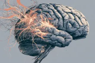 Encephalitis Survivors Face Widespread Psychiatric Sequelae