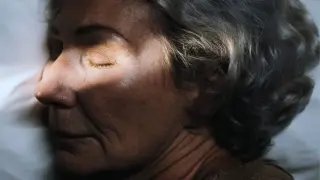 Sleep Waves May Shape Alzheimer’s Course, New Study Finds