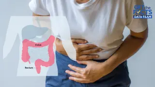 Colorectal Cancer Overtakes Lung Cancer as Second Leading Cause of Death, Driven by Surge in Younger Patients