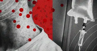 Measles Outbreaks Drive Race for New Treatments
