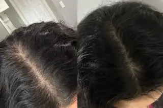 Women’s thinning hair decoded: expert tips and 13 science-backed products that actually help