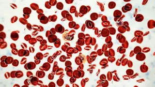 Silence Therapeutics' divesiran shows strong Phase 2 signals in polycythemia vera
