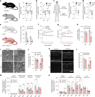 Cardiolipin Decline Drives Muscle Fiber Shifts in Aging