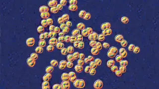 College microbiology class faces mass antibiotic scare after misidentified germ
