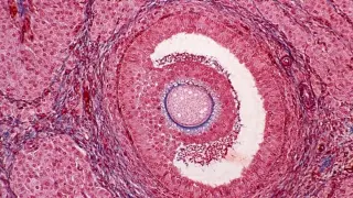 Ovaries Age Early, Reshaping Hormones and Immune Health Beyond Fertility