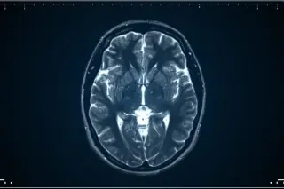 Stanford study reveals the brain has two separate origins during development