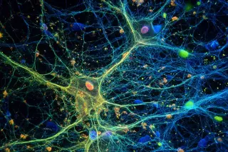 Microglial State Switch Reveals Dual Paths to Alzheimer’s Resilience