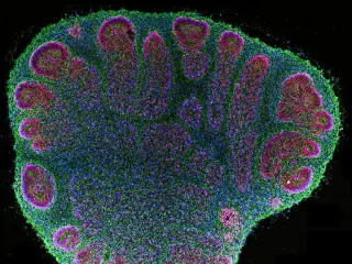 Bristol Researchers Demonstrate Brain Organoids Can Decode Braille Signals