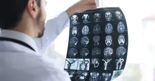 Fatherhood triggers rapid brain reorganization, study finds