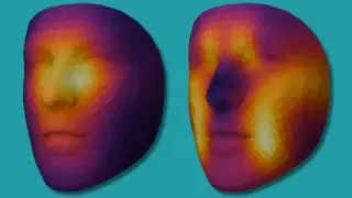 AI facial analysis tool predicts cancer survival from single photo