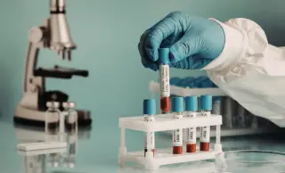 Blood biomarker pTau217 flags Alzheimer's risk years before symptoms
