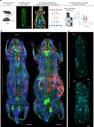 AI maps obesity-driven, body-wide cellular changes in mice with a three-part neural-immune-tissue framework