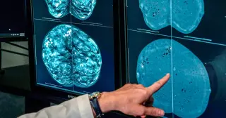 Mammogram timing diverges as experts push toward personalized screening