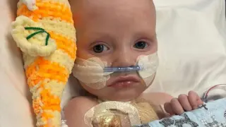 Berlin Heart Keeps Little Macs Thriving as He Awaits a Heart Transplant