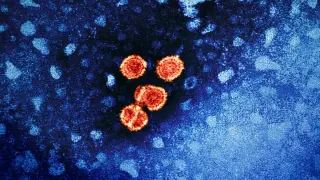 New Death Footprint Reveals How Viruses Hitch a Ride During Cell Cleanup