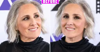 Ricki Lake Goes Public With Her Facelift Two Years On, Sharing Unfiltered Photos