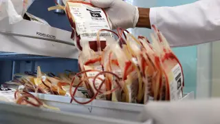 West Africa Urges Stronger Outbreak Detection to Shield Health Systems