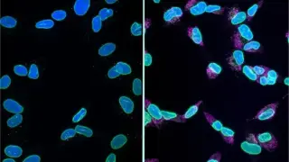 Nucleus collapse linked to dementia neuron death offers new therapy target