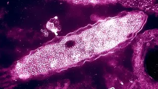 First death linked to NYC Legionnaires’ outbreak as cases rise to 67