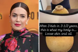 Mandy Moore Embraces Postpartum Reality: Loose Skin After 3 Kids in Under Four Years