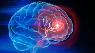 Engineered injectable scaffold spurs brain repair after stroke in mice