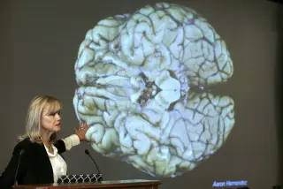 Large brain study links CTE to a quarter of deceased NFL players