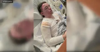 Yuba City McDonald’s worker badly burned after coworker throws hot oil
