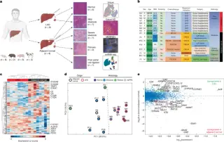 Live-donor atlas maps healthy liver zonation and early steatosis dynamics