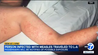Measles exposure alert for Union Station travelers