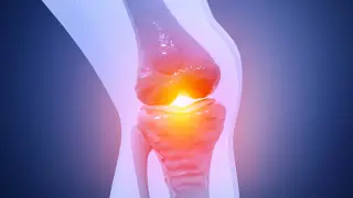 Yale Study Finds Epilepsy Drug Lacosamide May Reverse Osteoarthritis Damage via Hydrogel Delivery