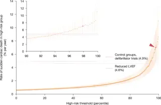 AI-detected ECG signature reveals new high-risk group for sudden cardiac death