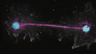 Fire amoeba shatters heat limits, surviving at 63C