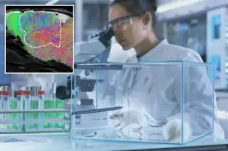 Stanford researchers graft human brain tissue into mice to study human neurodevelopment