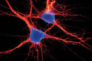 Tiny Brainstem Switch Triggers Week-Long Anxiety, Study Finds