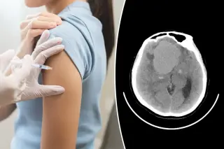 New study links several birth control pills to brain tumor risk