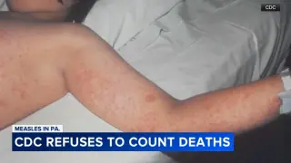 CDC chief delays two Pennsylvania measles deaths from weekly tally amid administration clash