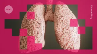 AI swarm targets CD276 in the hunt for a lung-cancer drug
