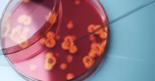 Drug-Resistant Candida Auris Spreads Across 23 States, Prompting Hospital Precautions