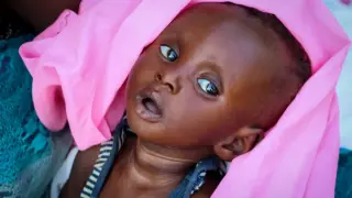 South Sudan teeters on the brink of hunger as millions face acute malnutrition